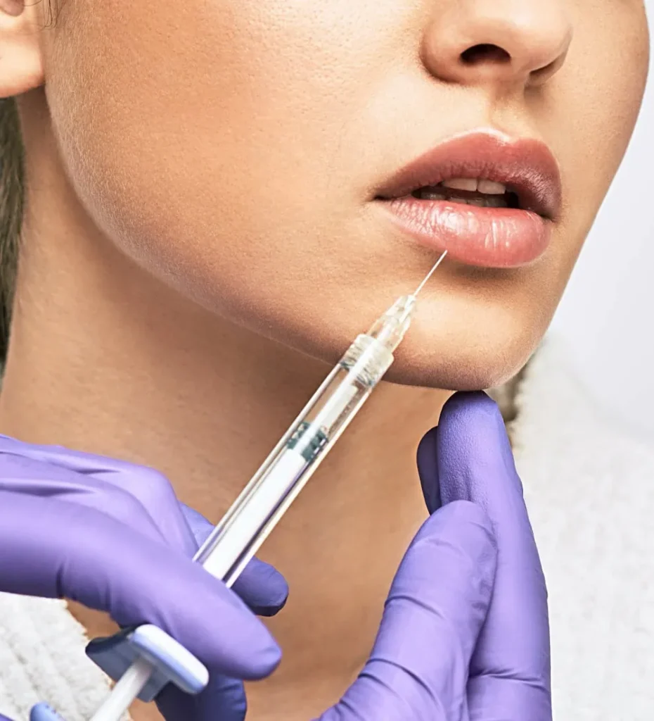 Women receiving dermal filler injections for their lips in Bellmore, NY.
