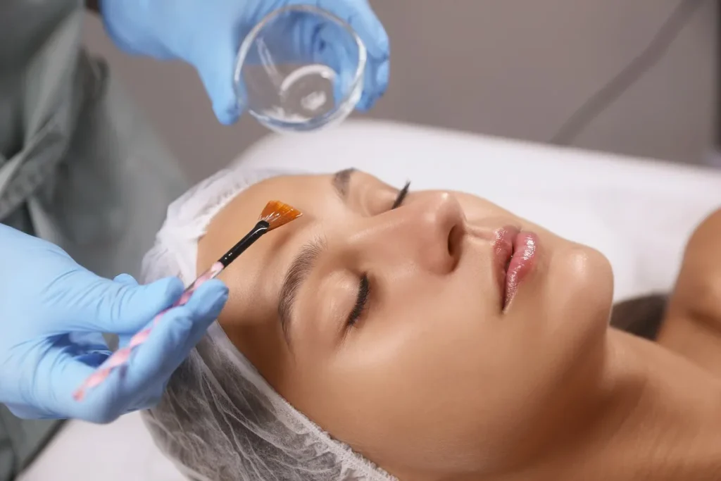 A woman is getting Chemical Peels applied to her face by a professional in Bellmore, NY