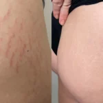 AG_M8_Thigh_Back_RS_Angl_Crop-TM