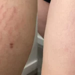 AG_M8_Thigh_Front_LS-TM