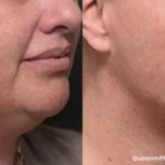 CL_QuantumRF10witnM8B_Face_RSide_Zoom-TM