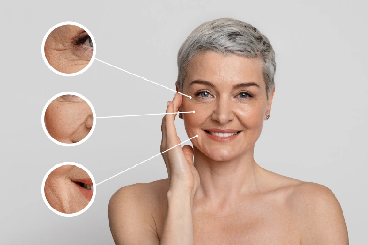 Woman receiving Sculptra treatment for facial aging and skin firmness at MICARI Aesthetics & Veins.