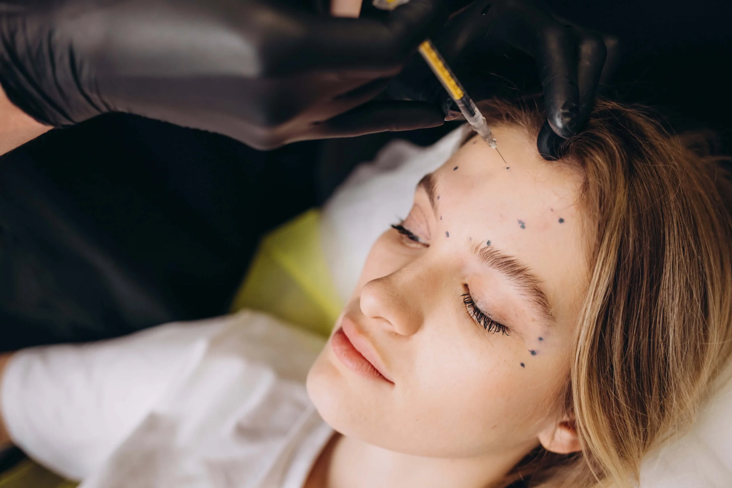 Woman receiving Botox Injections in Bellmore, NY for facial lines.